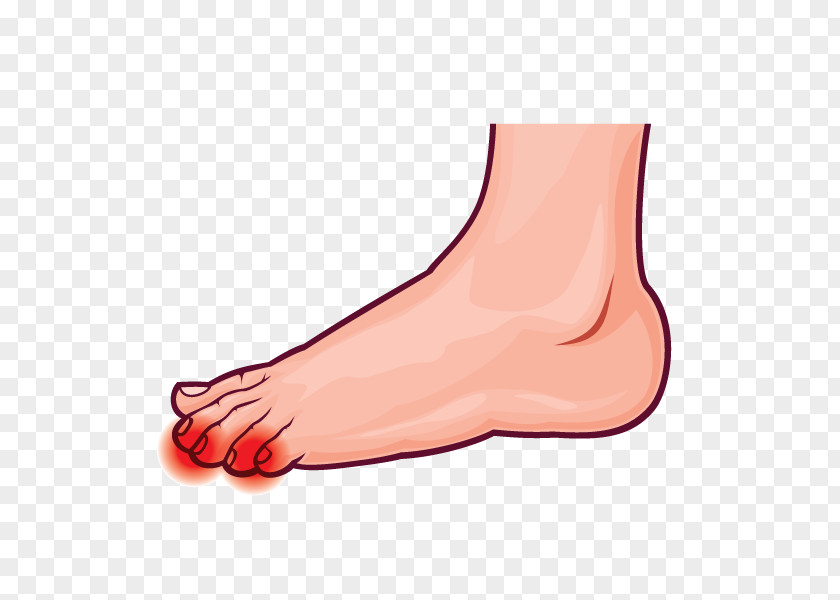 Ball Thumb Toe Ankle Pronation Of The Foot PNG