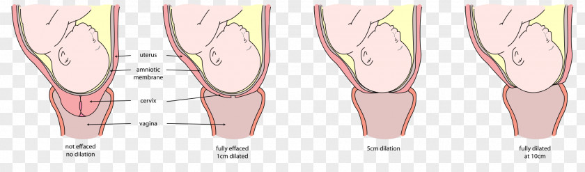 Pregnancy Cervical Dilation Effacement Cervix Childbirth PNG