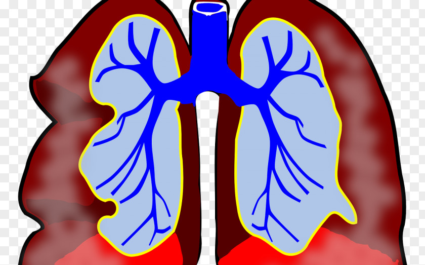 Dental Bacteria Cancer Awareness Ribbon Lung Clip Art PNG