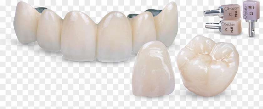 Crown Tooth Ceramic Dental Porcelain PNG