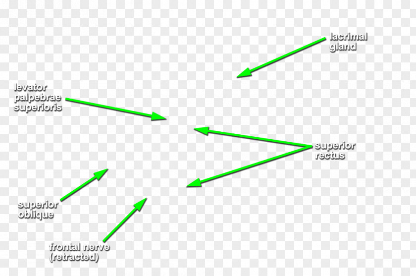 Line Angle Diagram PNG