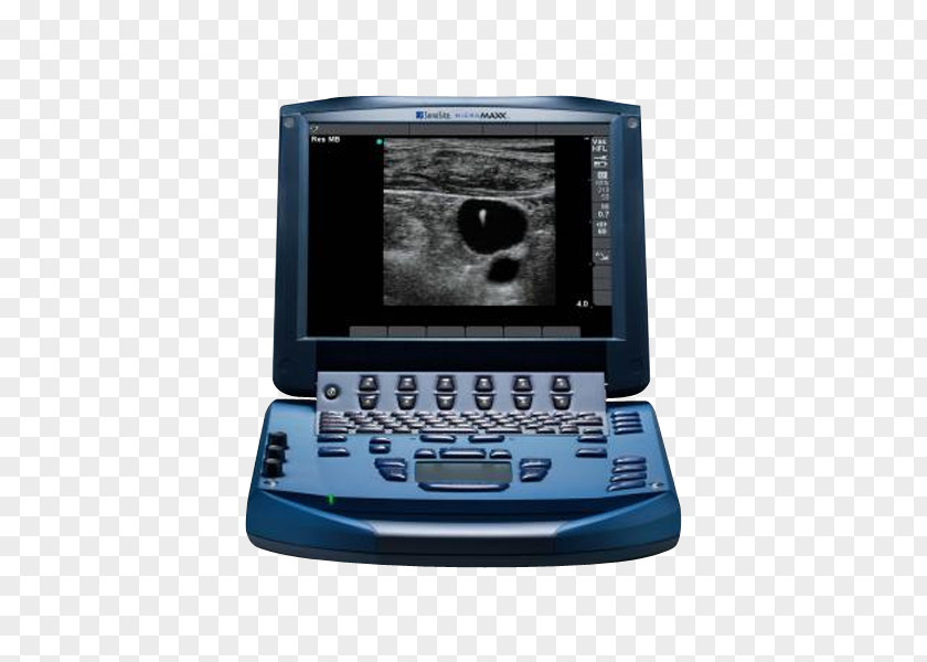 Ultrasound Machine Acuson Ultrasonography Portable SonoSite, Inc. PNG
