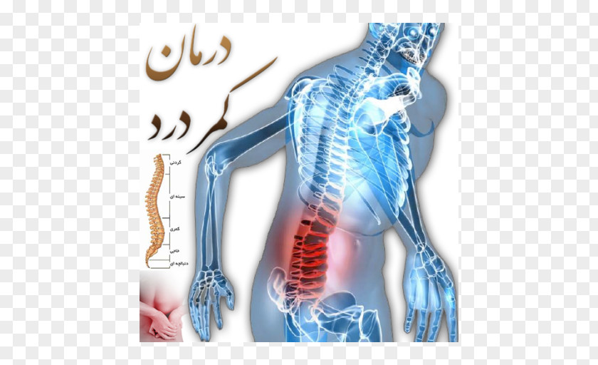 Backpain Pain In Spine Lumbar Disc Herniation Low Back Vertebral Column PNG