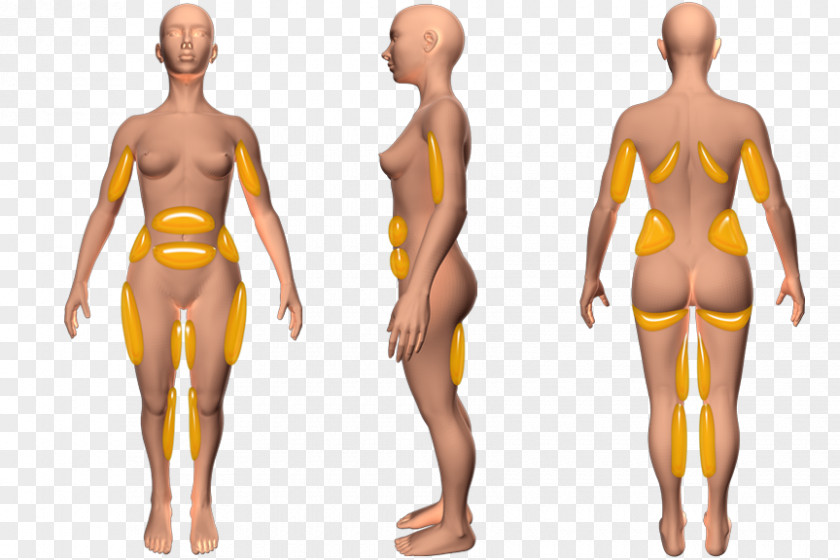 Arm Hip Abdomen Fat Abdominal Obesity Adipose Tissue PNG