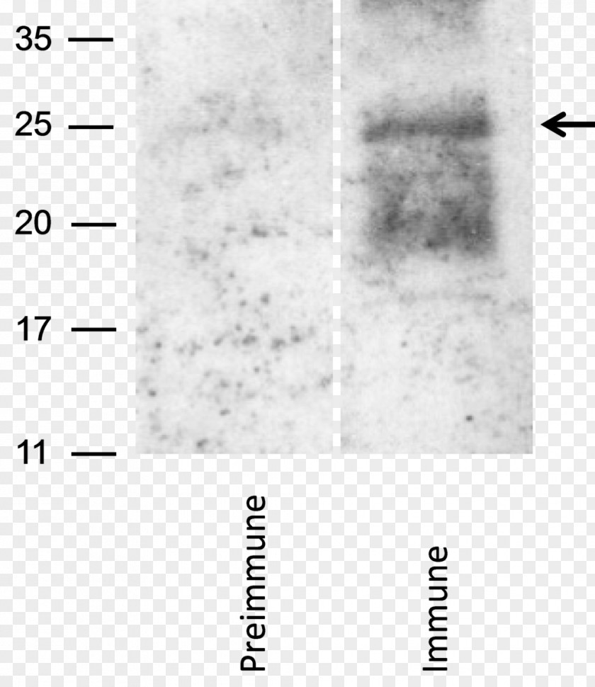 Sterilized Virus Antibody Reverse Transcriptase RNA Sf9 Cell PNG