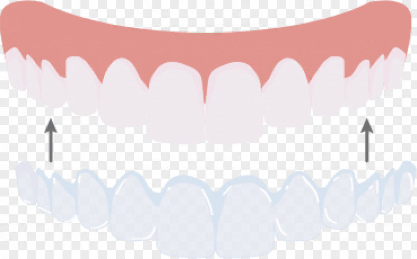 Design Tooth Jaw Mouth Pink M PNG