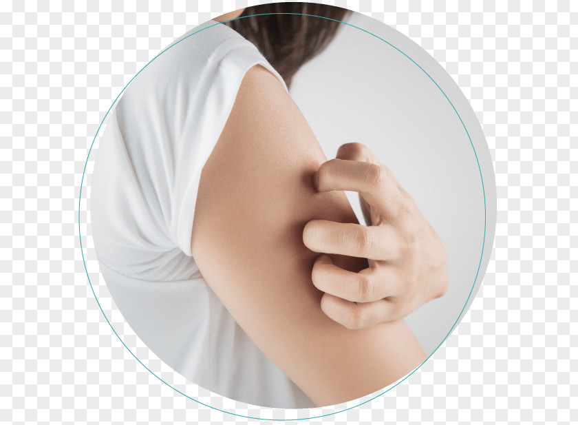Arm Itch La Peau Dermatology: Zaina Rashid, DO, FAOCD, FAAD Skin Rash Tinea Cruris Symptom PNG