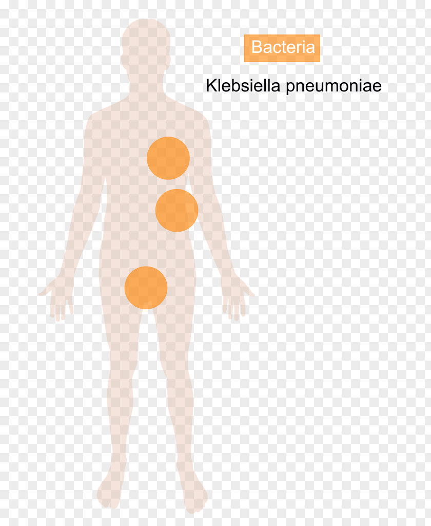 Bacterias Klebsiella Pneumoniae Oxytoca Bacteria Disease Streptococcus PNG
