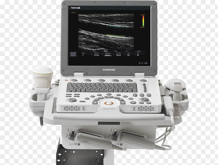 Medical Equipment Ultrasound Medicine Ultrasonography Ecógrafo PNG