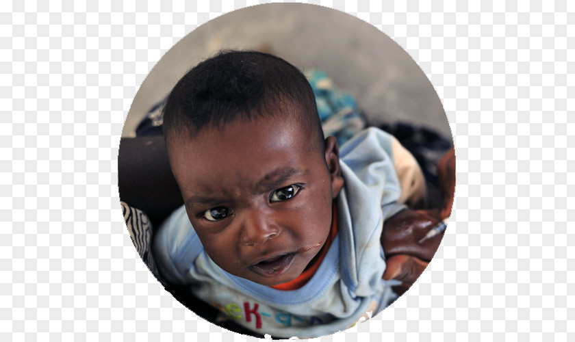 Child Malaria Vaccine Immunization Smallpox Rubella PNG