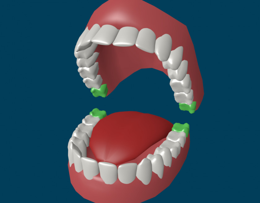 Tooth Human Wisdom Homo Sapiens Deciduous Teeth PNG