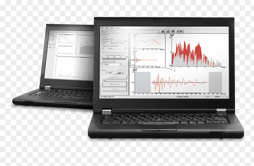 Otoacoustic Emission System Information Computer Software Digital Data PNG