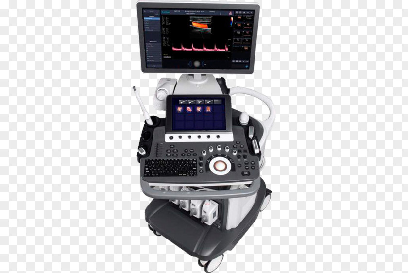 Ultrasonography Doppler Echocardiography Ultrasound SonoScape Medical Corp Imaging PNG