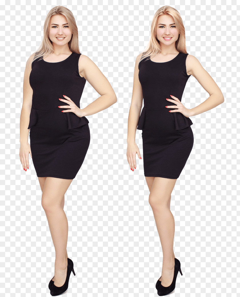 Healthy Weight Loss Dress Stock Photography Clothing Fashion PNG