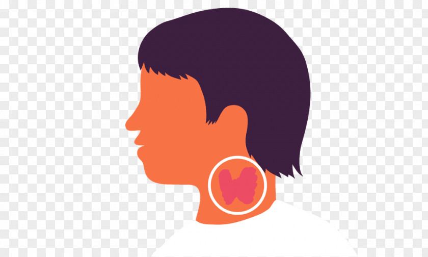 Thyroid Cancer Disease Hashimoto's Encephalopathy Iodine PNG