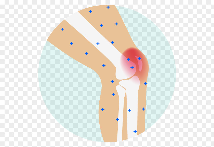 Knee Pain Management Analgesic Joint Arthritis Back PNG