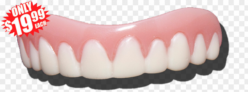 Human Tooth Dentures Veneer Wisdom PNG