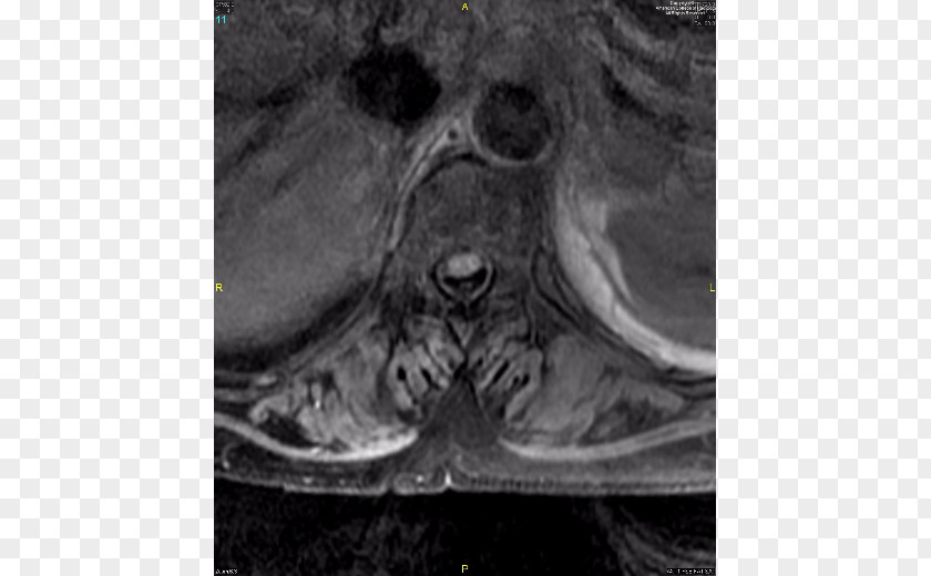 November 16 Medical Imaging Stock Photography Snout Close-up PNG