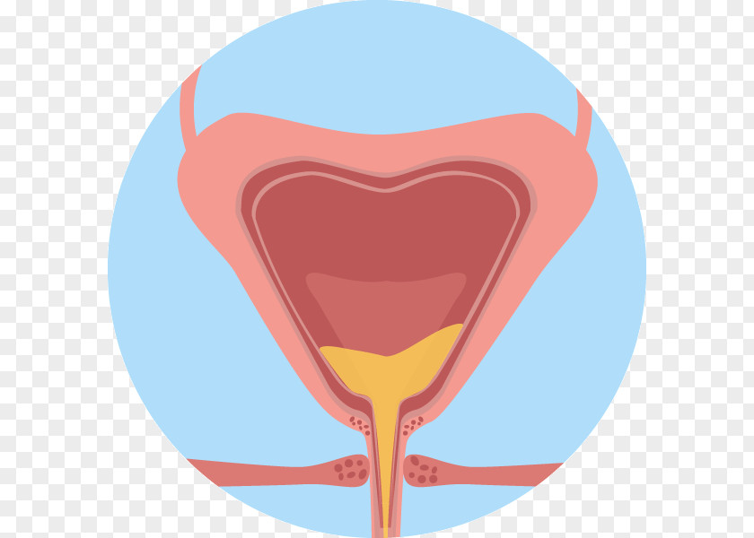 Maple Grove Urinary Bladder Overactive Tract Infection Kidney Clip Art PNG