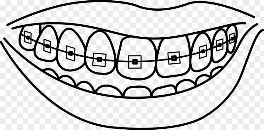 Tooth Cavity Dental Braces Dentistry Human Drawing PNG