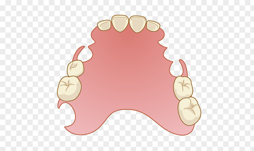 Tooth Dentistry Dentures Removable Partial Denture Mouth PNG