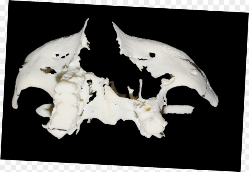 Skull Palatal Obturator Oroantral Fistula Printing Maxillary Sinus Free Flap PNG