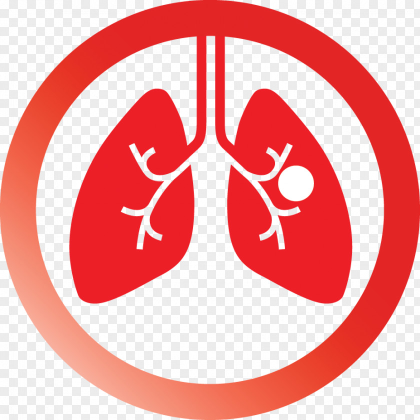 Cancer Patient Non-small Cell Lung Small-cell Carcinoma Squamous Skin PNG