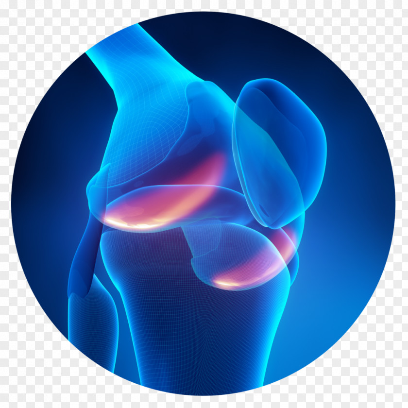 Knee Pain Bone Joint PNG