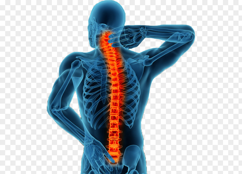 Vertebral Column Minimally Invasive Spine Surgery Spinal Fusion Back Pain PNG