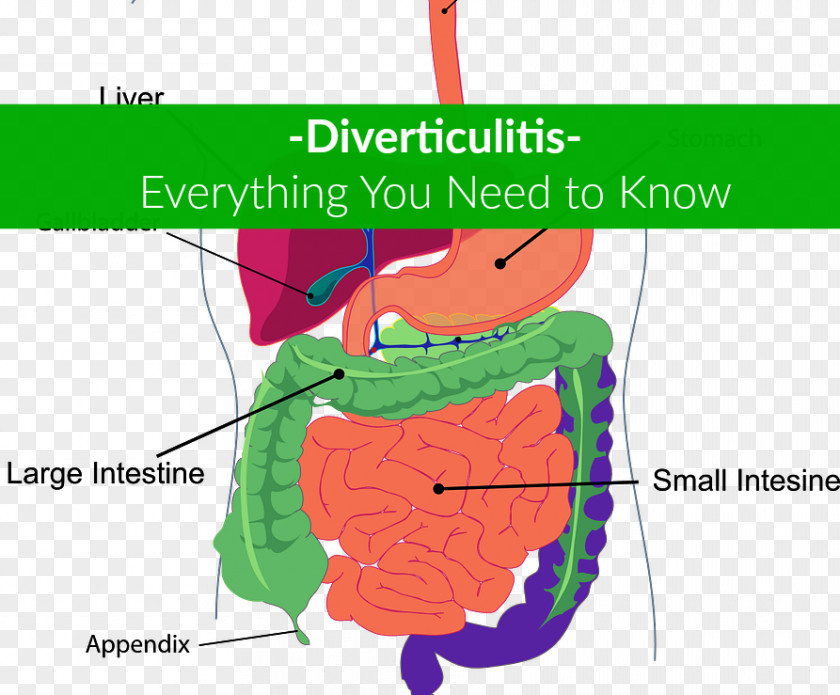 Diverticulosis Human Digestive System Digestion Gastrointestinal Tract Body Clip Art PNG