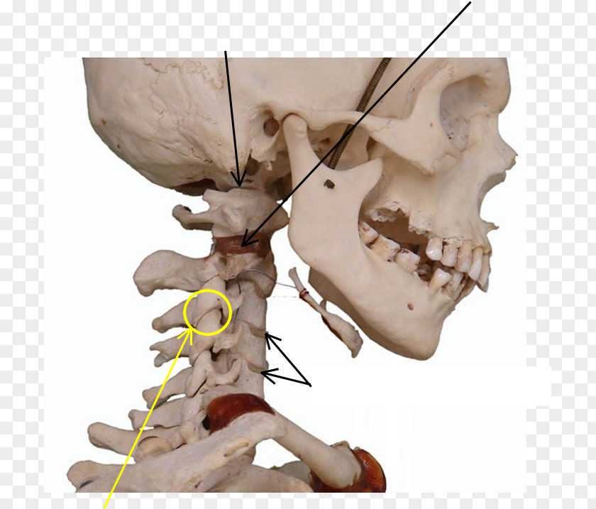 Ligament Bone Skeleton Joint Jaw Skull PNG