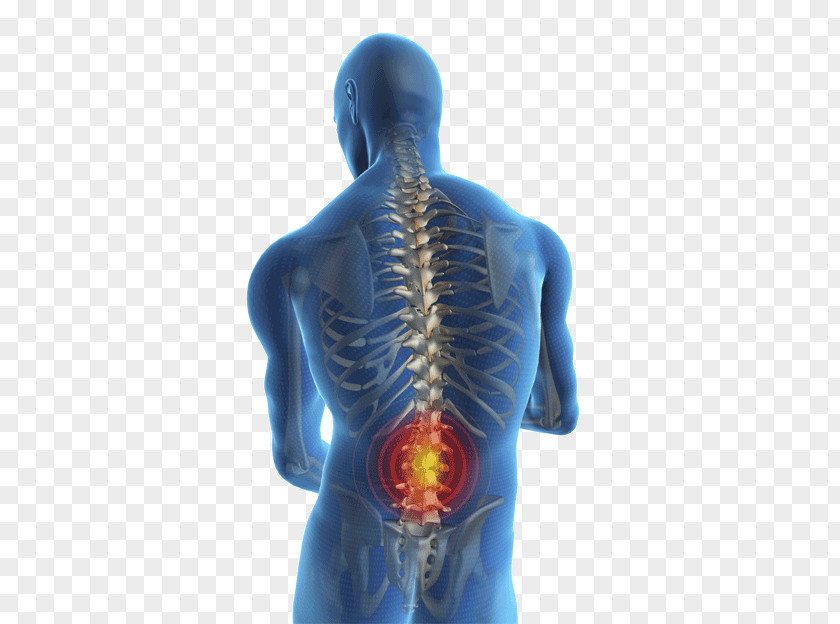 Lumbar Disc Disease Low Back Pain Injury Human Management PNG
