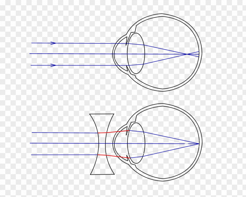 Eye Near-sightedness Far-sightedness Visual Perception Presbyopia PNG