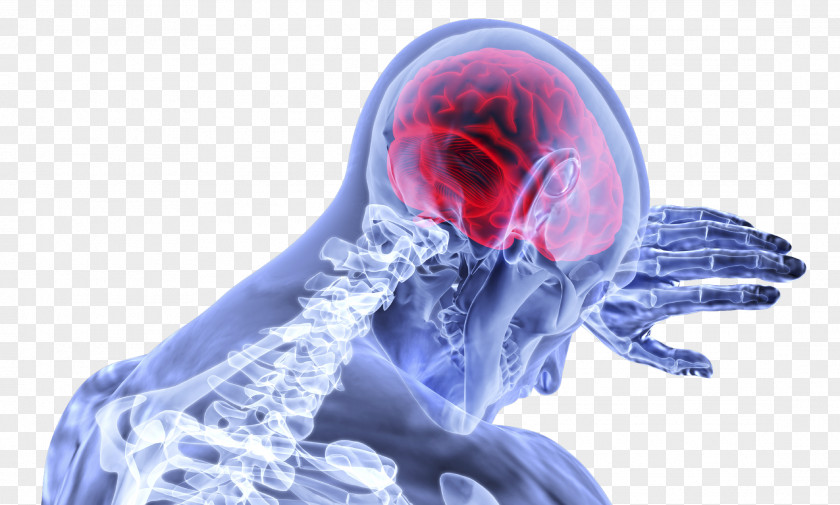 Brain Traumatic Injury Concussion PNG