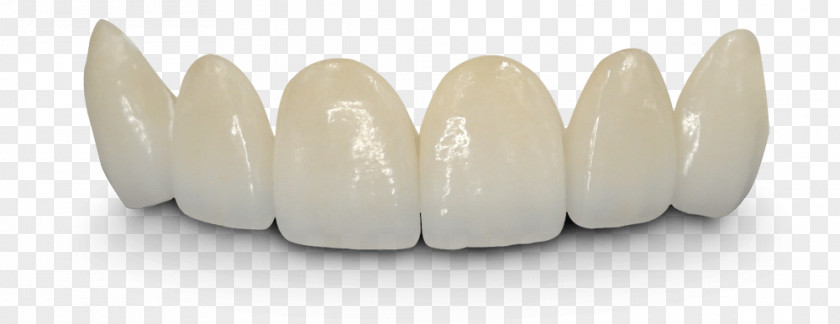 Bridge Crown Dentistry Dentures Tooth PNG