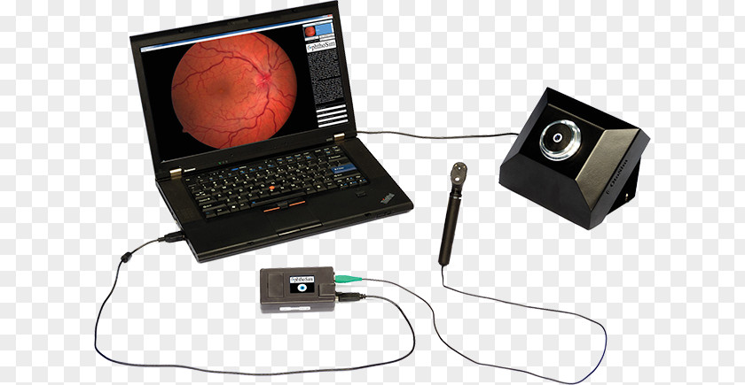 Ophthalmoscopy Simulation Virtual Reality Simulator Virtuality PNG