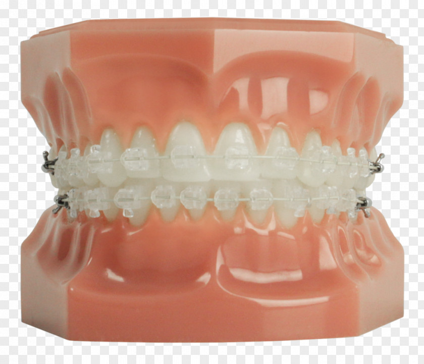 Dental Smile Tooth Dentistry Braces Clear Aligners PNG