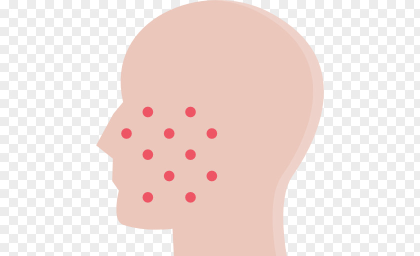 Asistencia Nummular Dermatitis Cheek Skin Eczema PNG