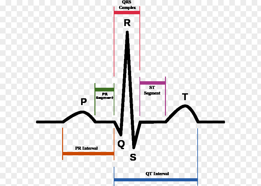 Heart Rate Electrocardiography QT Interval Long Syndrome PR QRS Complex PNG