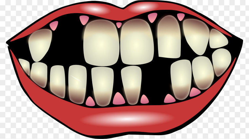Bright Teeth Cliparts Tooth Pathology Decay Dentistry Clip Art PNG