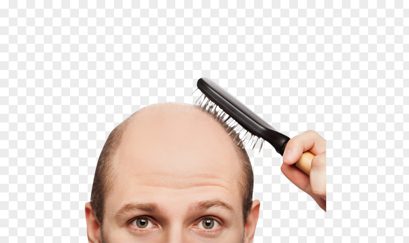 Hair Loss Health Care Scalp PNG