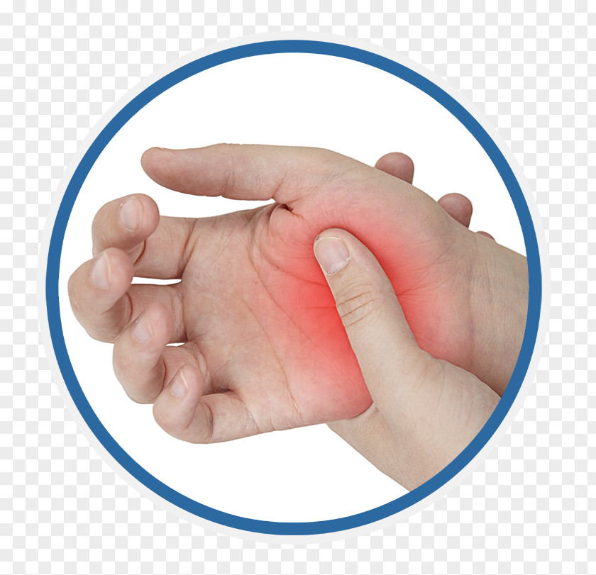 Hand Pain Hypoesthesia Rheumatoid Arthritis PNG