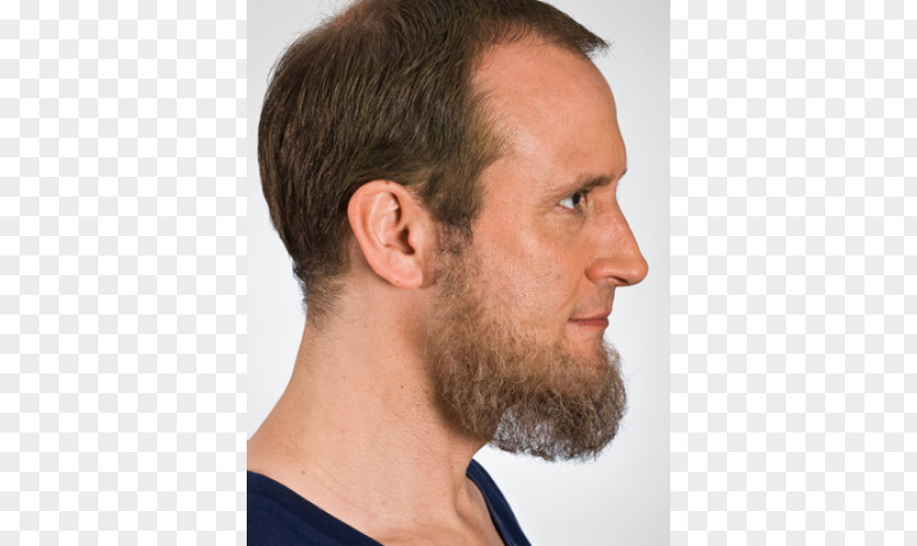 Real Beard Sideburns Hair Moustache Chin PNG