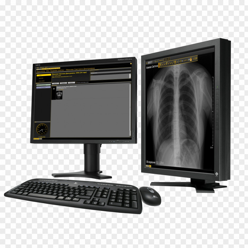 Dentistry Health Technology System Computer Hardware Medicine PNG