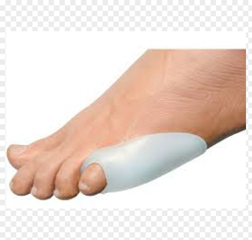 Corn Tailor's Bunion Toe Medicine Podiatry PNG