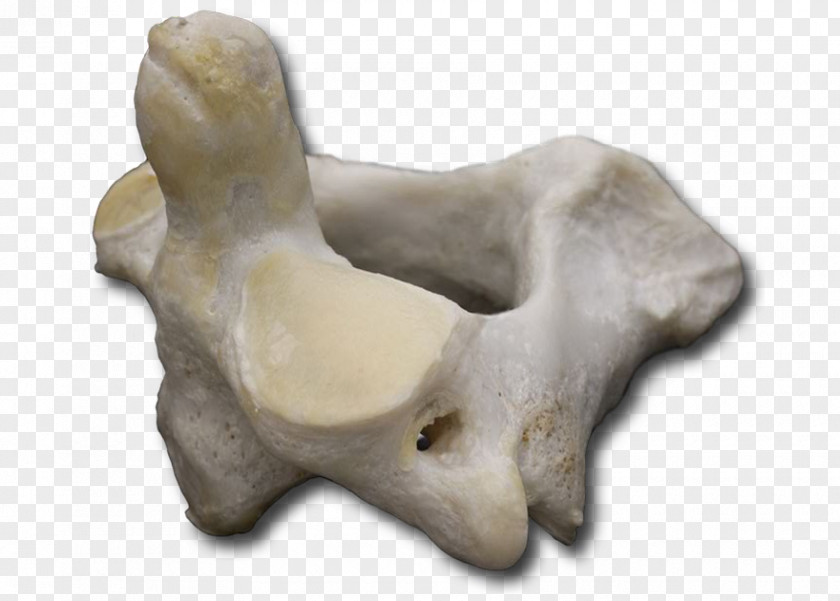 Cervical Vertebra Atlas Bone Sculpture Vertebral Column VH Dissector PNG