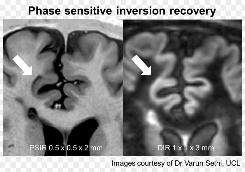 Nose Medical Imaging Human Behavior Radiography Homo Sapiens PNG