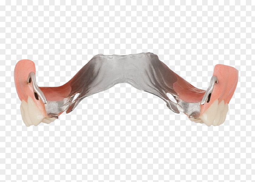 Aspen Dental Dentures Removable Partial Denture Dentistry Industry PNG