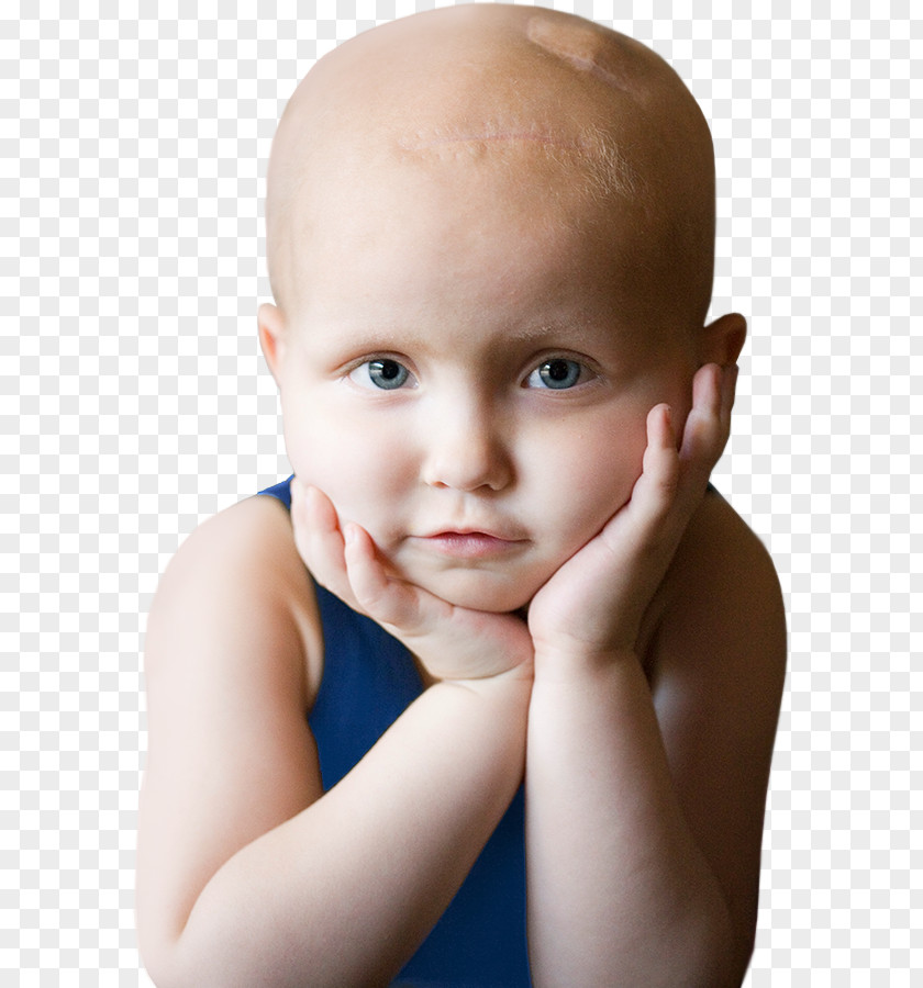 Cancer Childhood Pediatrics Toddler PNG
