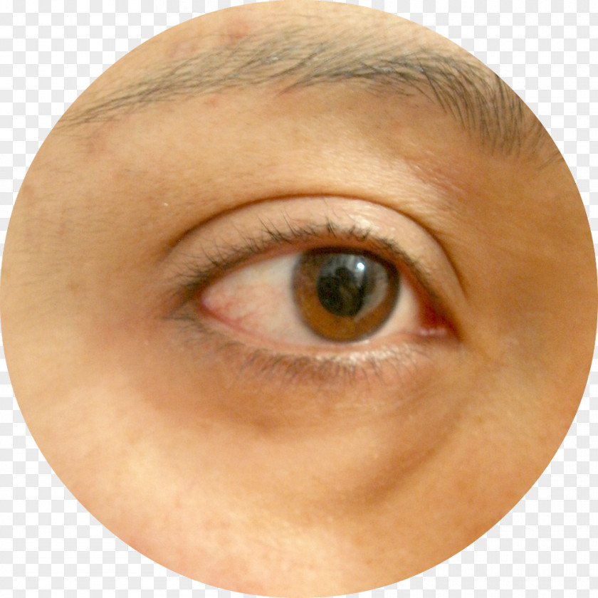 Eye Patch Eyelash Extensions Chin Wrinkle Cheek Eyebrow PNG